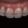 bracket zafiro elegant diamond