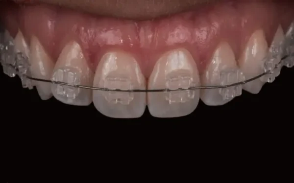 bracket zafiro elegant diamond