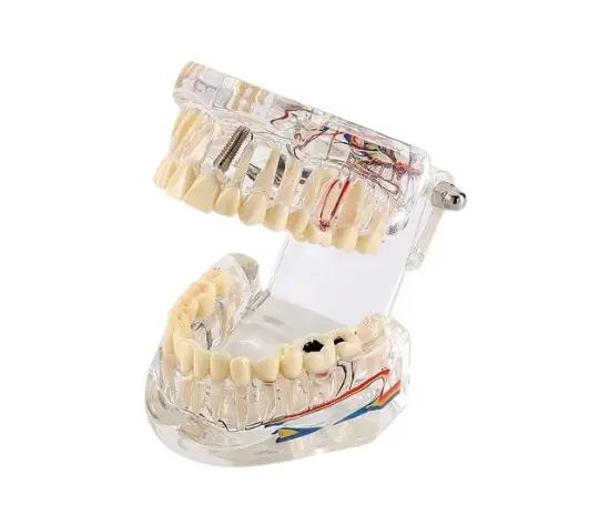Macro modelo implantes + nervio neural